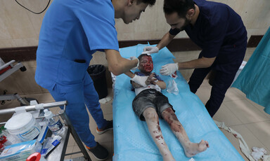Two men wearing scrubs stand on opposite sides of a kindergarten-aged boy lying on a hospital bed with a bloody face
