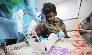 A bloodied young boy with black soot on one side of his face has a splint on his leg as he sits on a hospital bed and an adult wearing protective clothing holds his arm