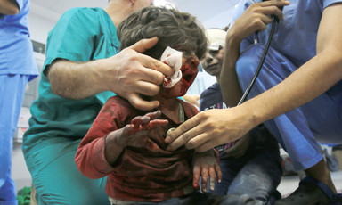 Men in scrubs hold gauze to the bloodied face of a toddler and a stethoscope to the child's heart