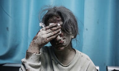 A girl covered in grey dust holds a bandage to her bloodied face while sitting in front of a blue curtain