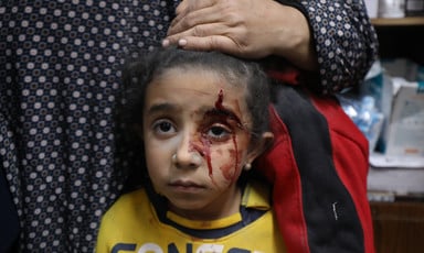 A woman places her hand on the head of a young child with a wound above one of his eyes