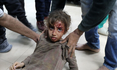A child with blood on her face 