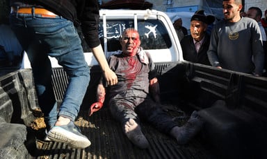 An older man whose face and body is covered in blood sits in the bed of a pickup truck