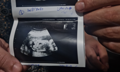 Two hands hold up an ultrasound image 