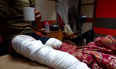 A man whose leg has been amputated sits on a bed and holds a mug