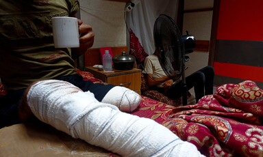 A man whose leg has been amputated sits on a bed and holds a mug