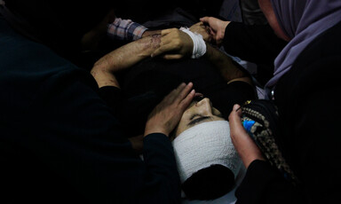 Hands hold the face of a dead man on a stretcher 