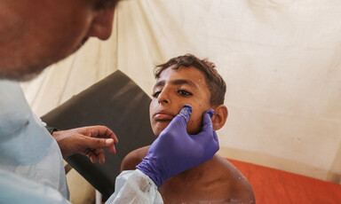 A man wearing a purple glove puts his thumb on the cheek of a boy sitting on a medical bed