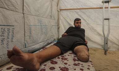 A man with one leg amputate lies on a bed in a tent.