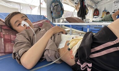 A Palestinian child rests in a hospital bed with tubes connected to his abdomen and nose