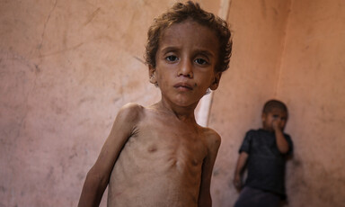 Portrait of an emaciated child