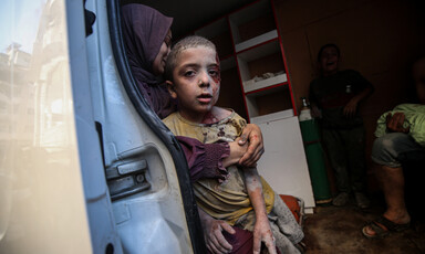 A small boy with dust, ash and blood on his face looks at the camera as he is being held by a woman inside an ambulance.