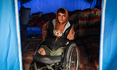 a man sitting on a wheelchair with his left arm and two legs amputated
